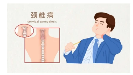 About Insomnia? Have you considered the cause of the cervical spine?